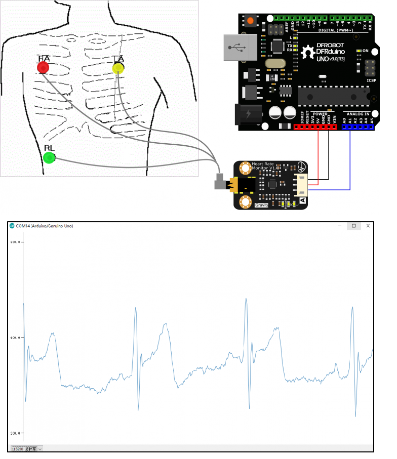 Arduino Nano Bundle: CrazyCircuits, DFRobot Sensors & Tools – Build Projects with Confidence