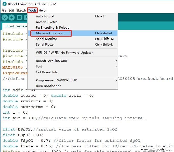 Arduino Blood Oxygen & Body Temperature Monitor – Build a Dual‑Sensor System