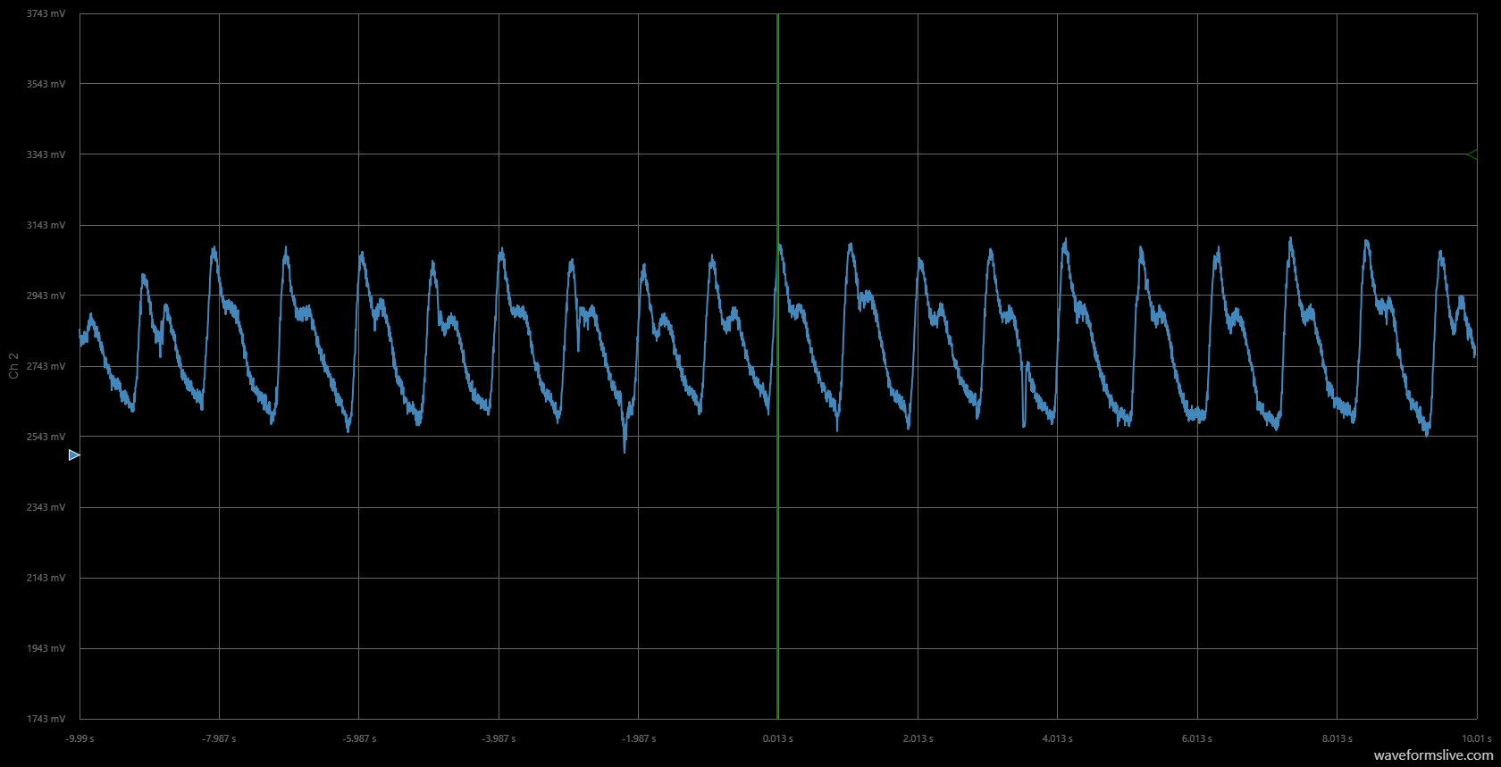 Build an Accurate Heart‑Rate Monitor with a Photoresistor and Arduino