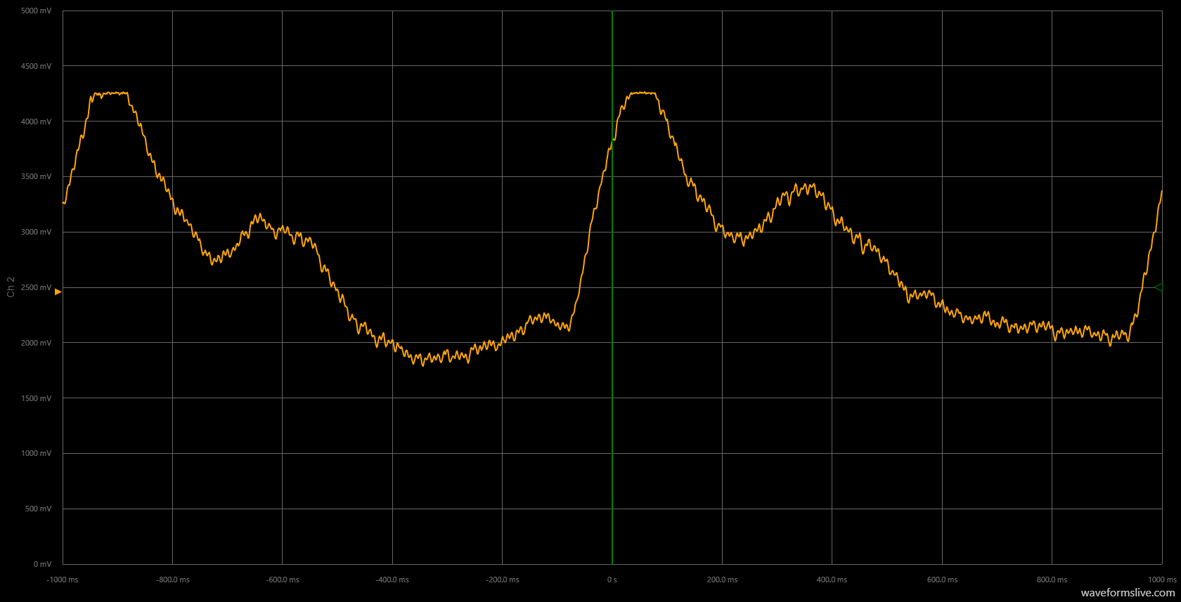 Build an Accurate Heart‑Rate Monitor with a Photoresistor and Arduino