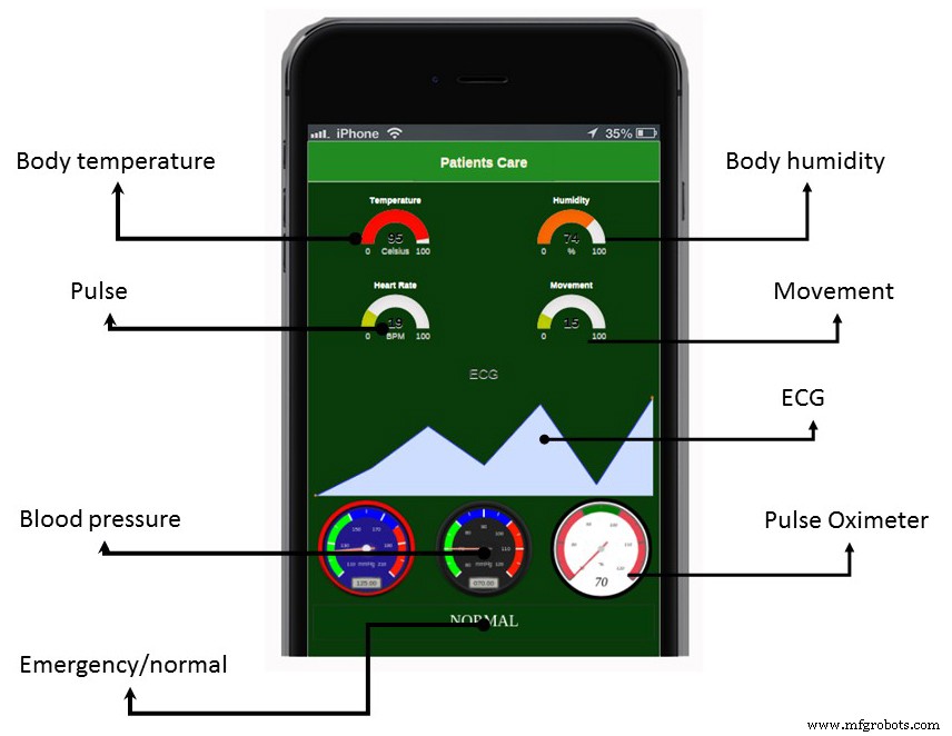 LoRa‑Enabled COVID‑19 Patient Monitoring System for Remote Health Care