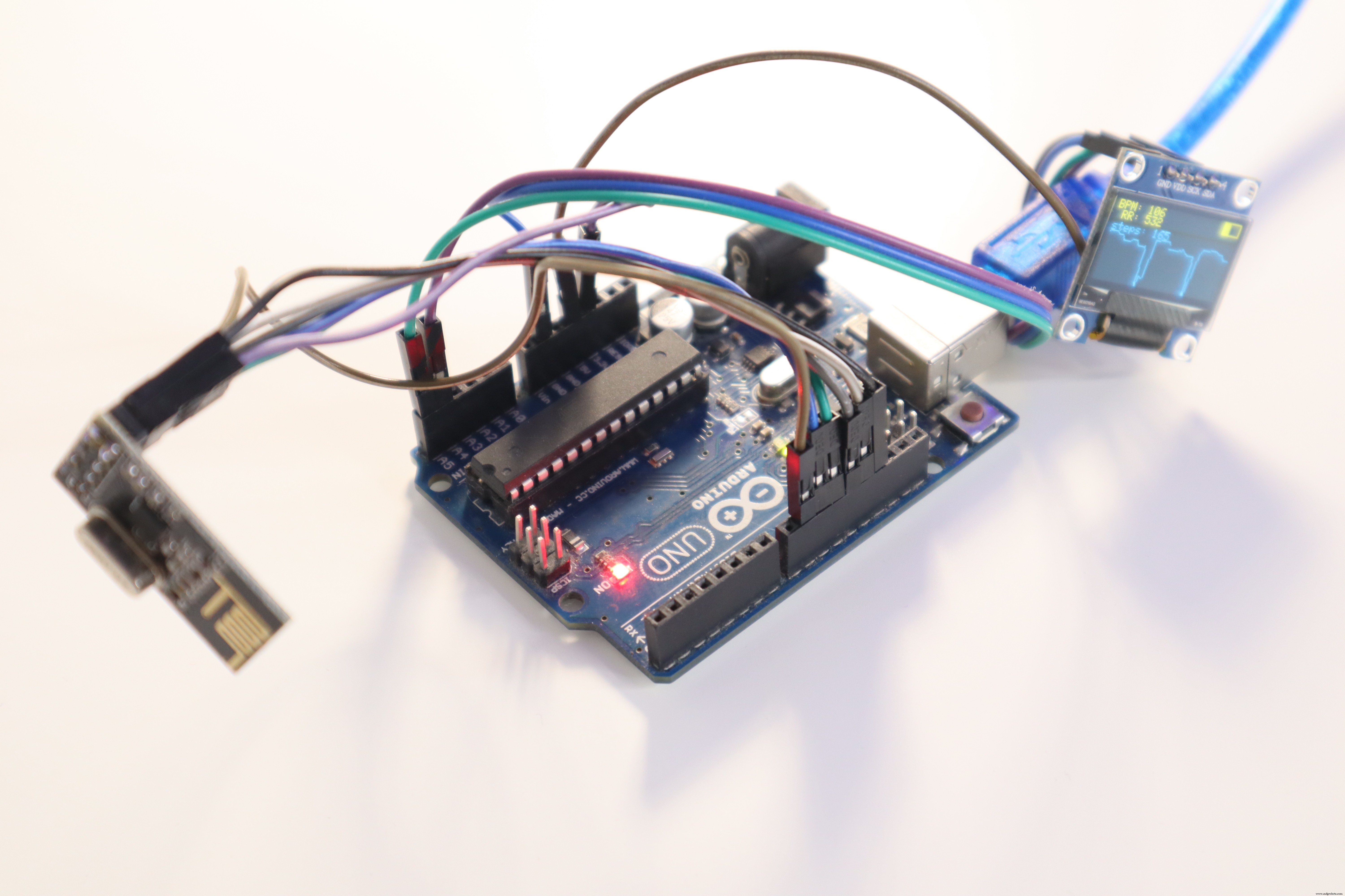 Realtime ECG Display on OLED with Arduino UNO
