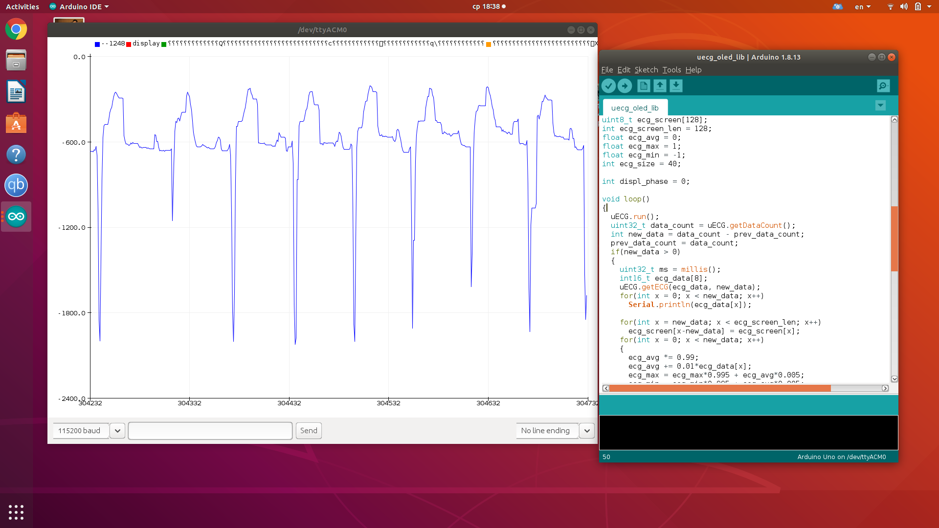 Realtime ECG Display on OLED with Arduino UNO