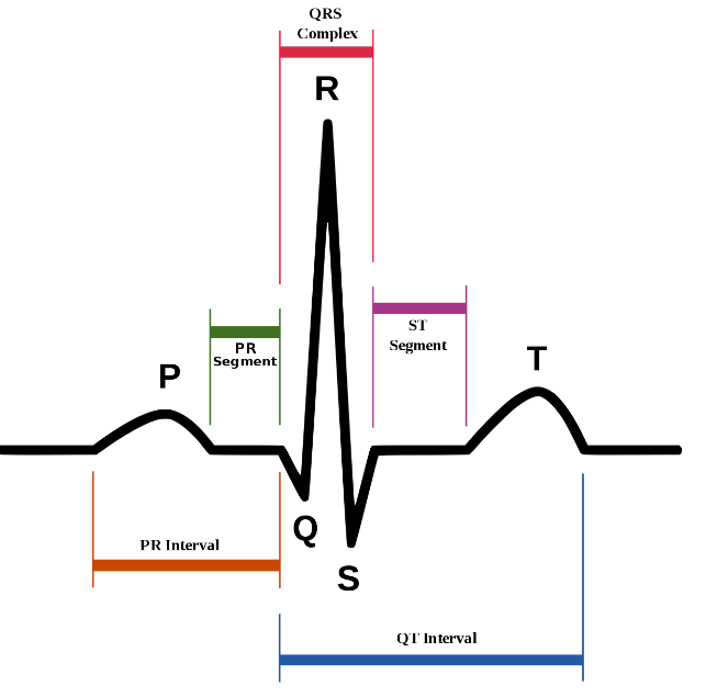 Precision ECG Analyzer with Edge Impulse and Arduino Nano 33 BLE Sense