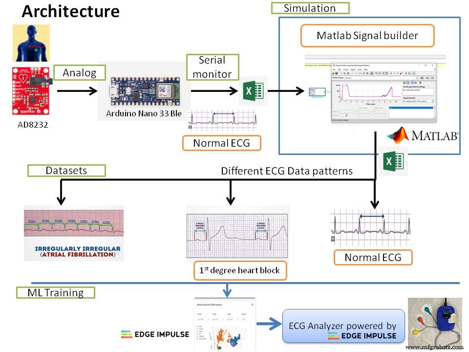 Precision ECG Analyzer with Edge Impulse and Arduino Nano 33 BLE Sense