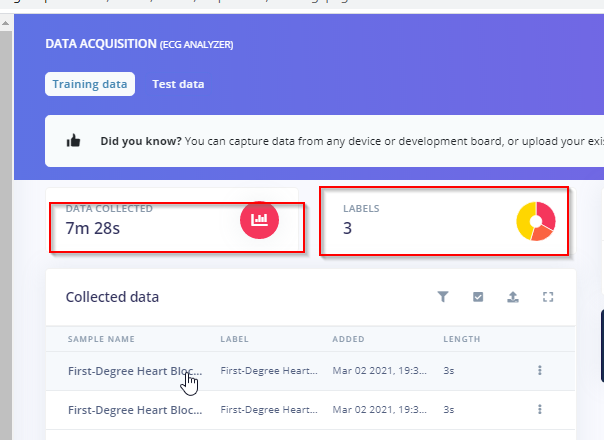 Precision ECG Analyzer with Edge Impulse and Arduino Nano 33 BLE Sense