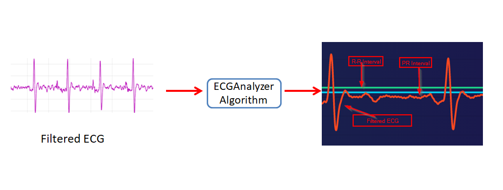 Precision ECG Analyzer with Edge Impulse and Arduino Nano 33 BLE Sense