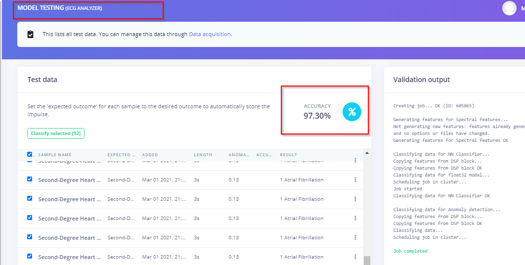 Precision ECG Analyzer with Edge Impulse and Arduino Nano 33 BLE Sense