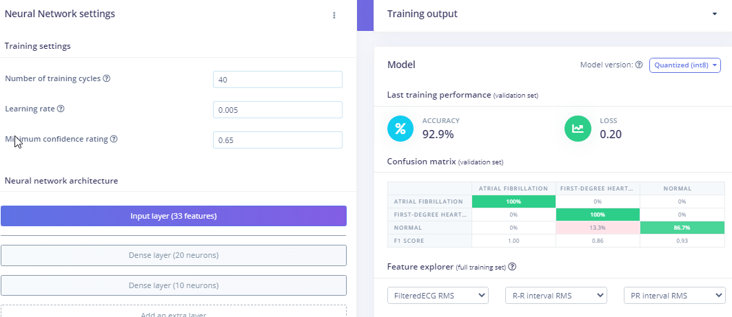 Precision ECG Analyzer with Edge Impulse and Arduino Nano 33 BLE Sense
