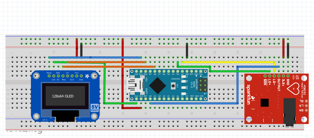 Precision ECG Analyzer with Edge Impulse and Arduino Nano 33 BLE Sense