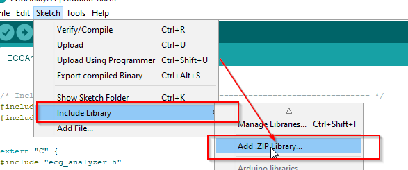 Precision ECG Analyzer with Edge Impulse and Arduino Nano 33 BLE Sense