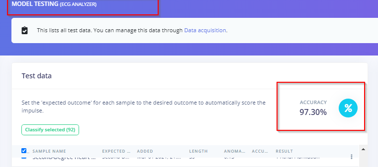 Precision ECG Analyzer with Edge Impulse and Arduino Nano 33 BLE Sense
