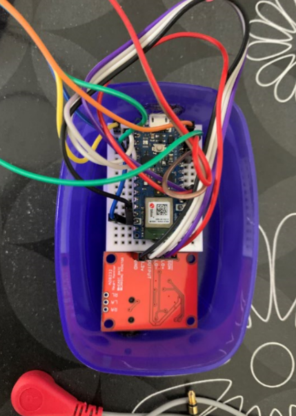 Precision ECG Analyzer with Edge Impulse and Arduino Nano 33 BLE Sense