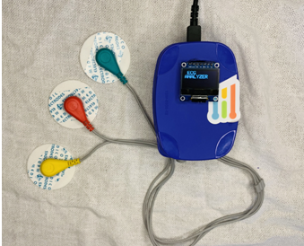 Precision ECG Analyzer with Edge Impulse and Arduino Nano 33 BLE Sense