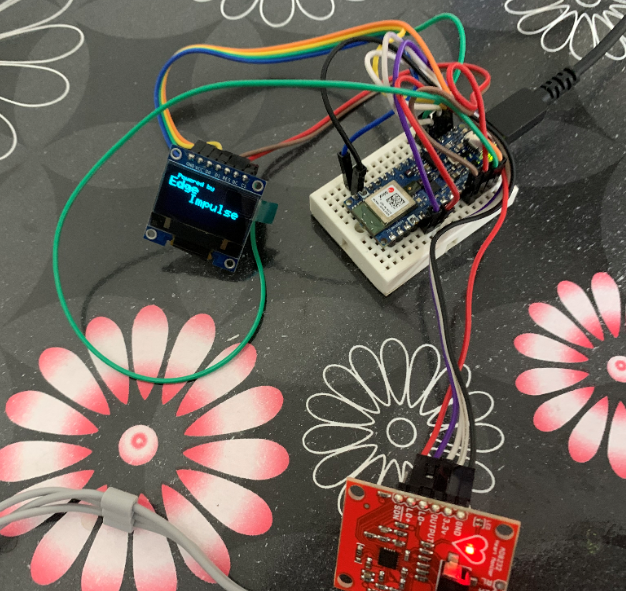 Precision ECG Analyzer with Edge Impulse and Arduino Nano 33 BLE Sense