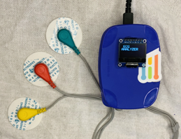 Precision ECG Analyzer with Edge Impulse and Arduino Nano 33 BLE Sense