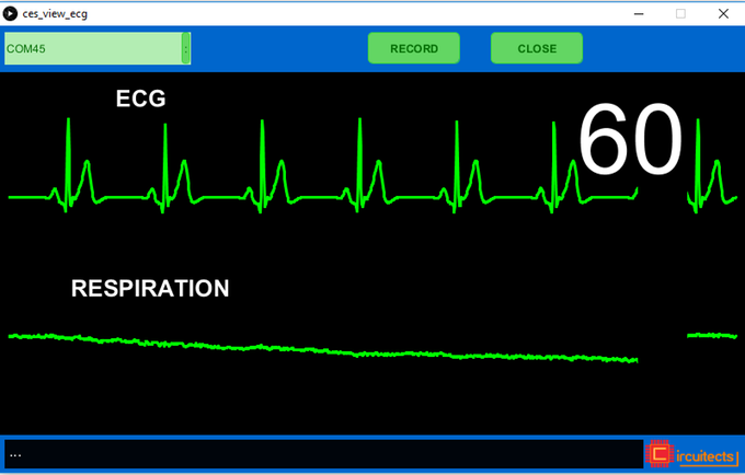 Build an Arduino-Based ECG & Respiration Monitoring System