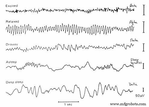 Control Your Robot with Brainwaves: A Comprehensive Arduino Project