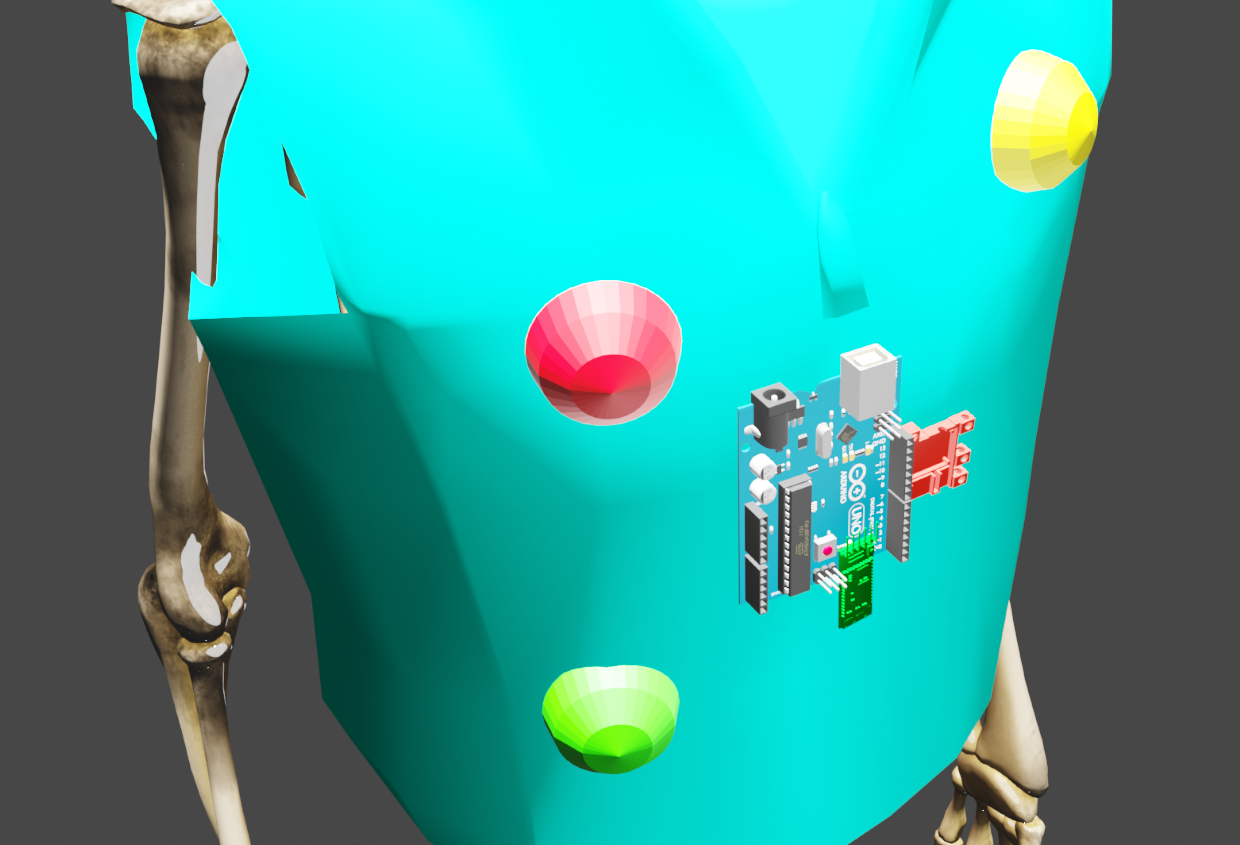 Advanced Arduino-Based ECG Monitor for Real-Time Heart Rate Detection