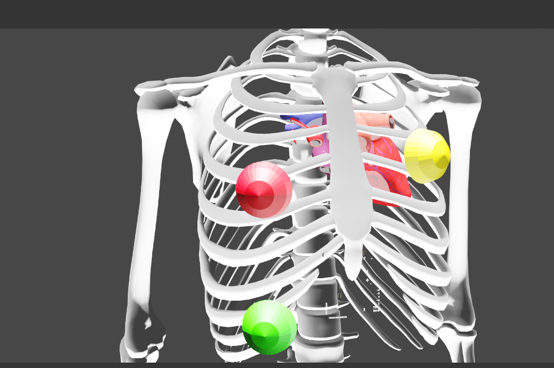 Advanced Arduino-Based ECG Monitor for Real-Time Heart Rate Detection