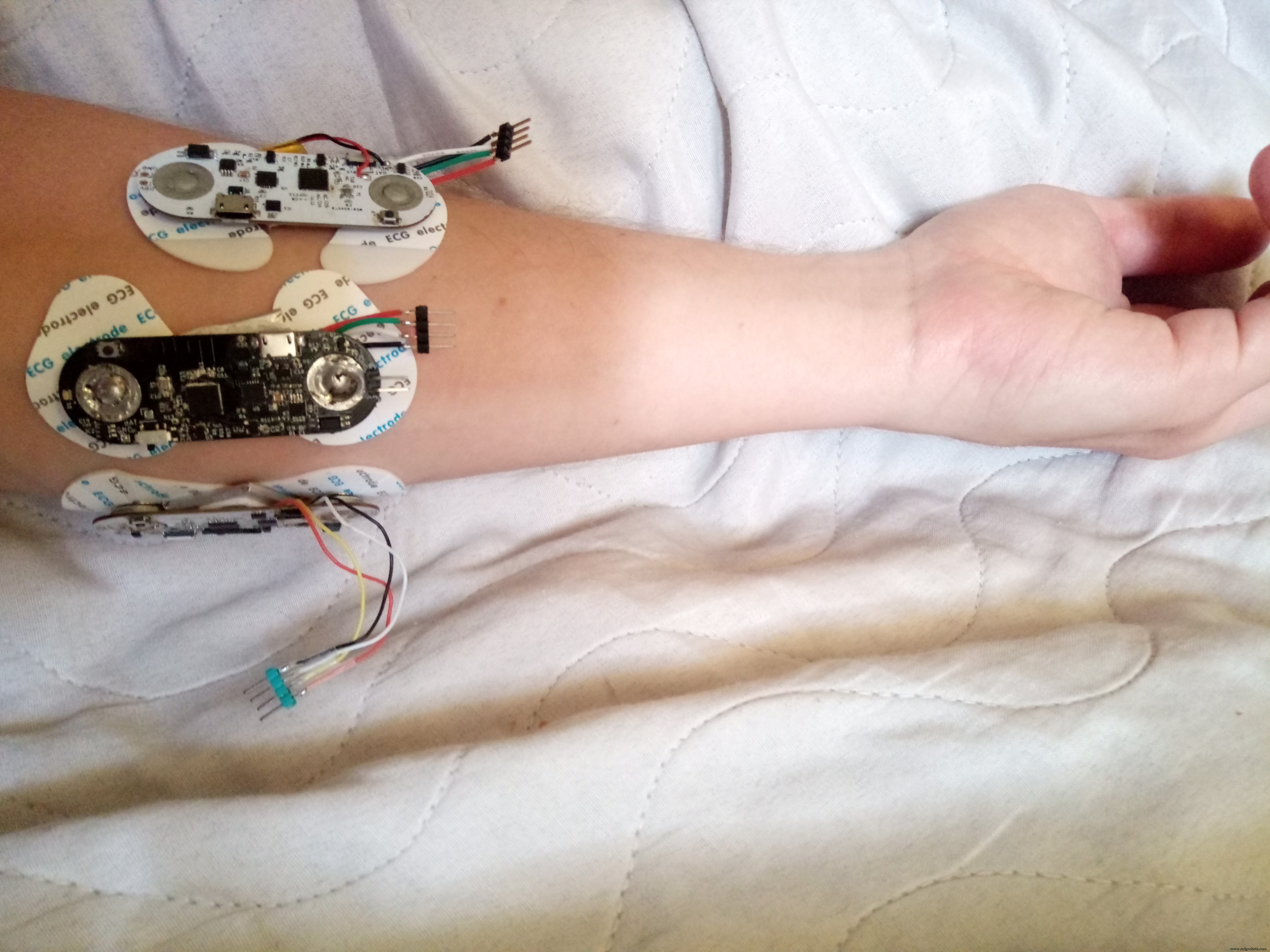 Precise EMG-Controlled Robotic Hand: InMoov Integration & Build Guide