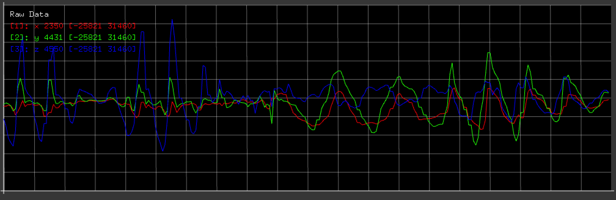 Gesture Recognition with ESP32 and Arduino 101 Accelerometer – Easy DIY Tutorial