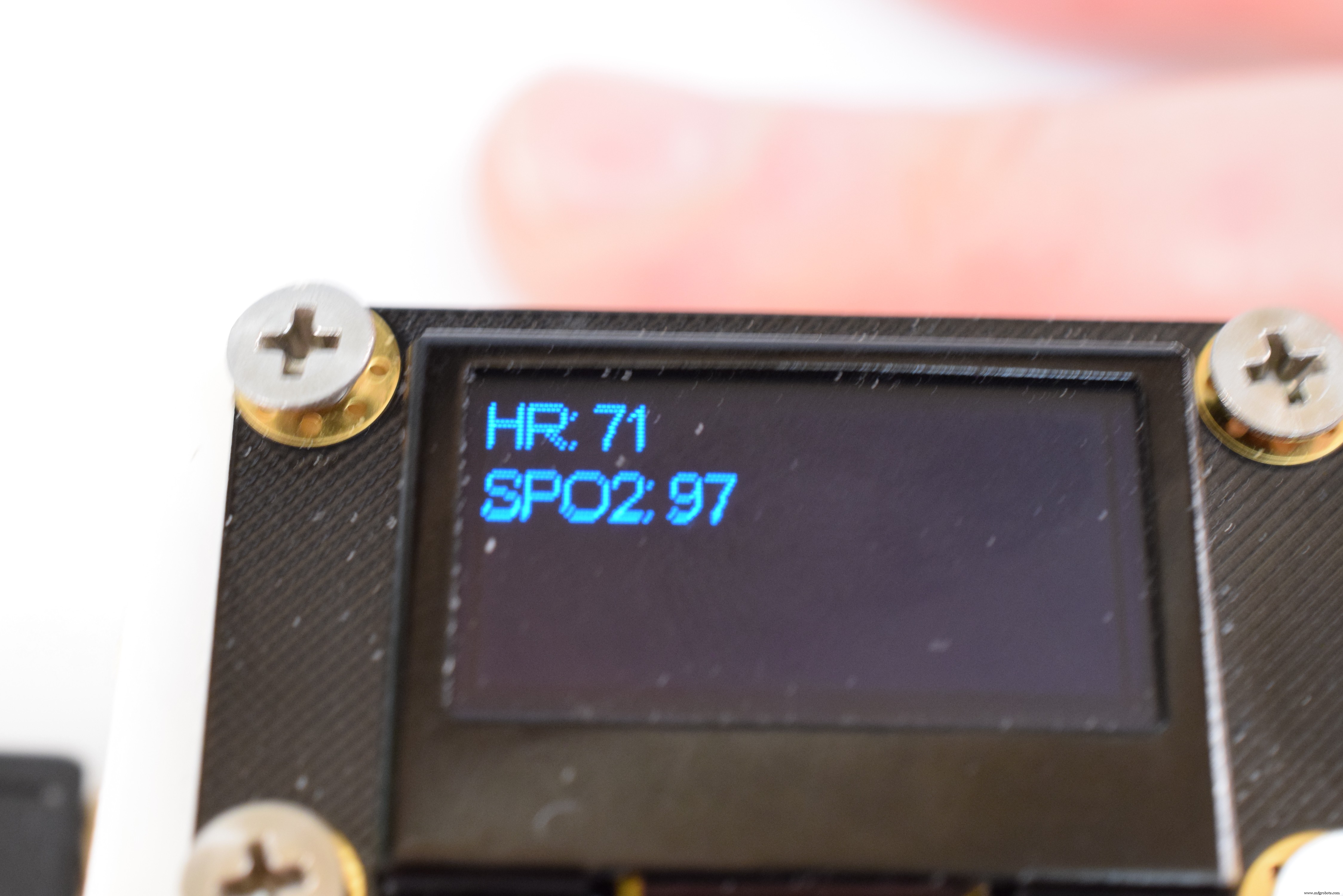 DIY Open-Source Pulse Oximeter for COVID-19: Arduino Build