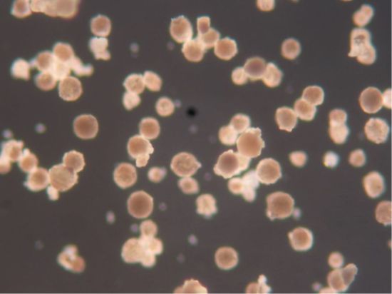 PEEK vs. PEKK: Selecting the Optimal Thermoplastic for Future Aircraft Structures