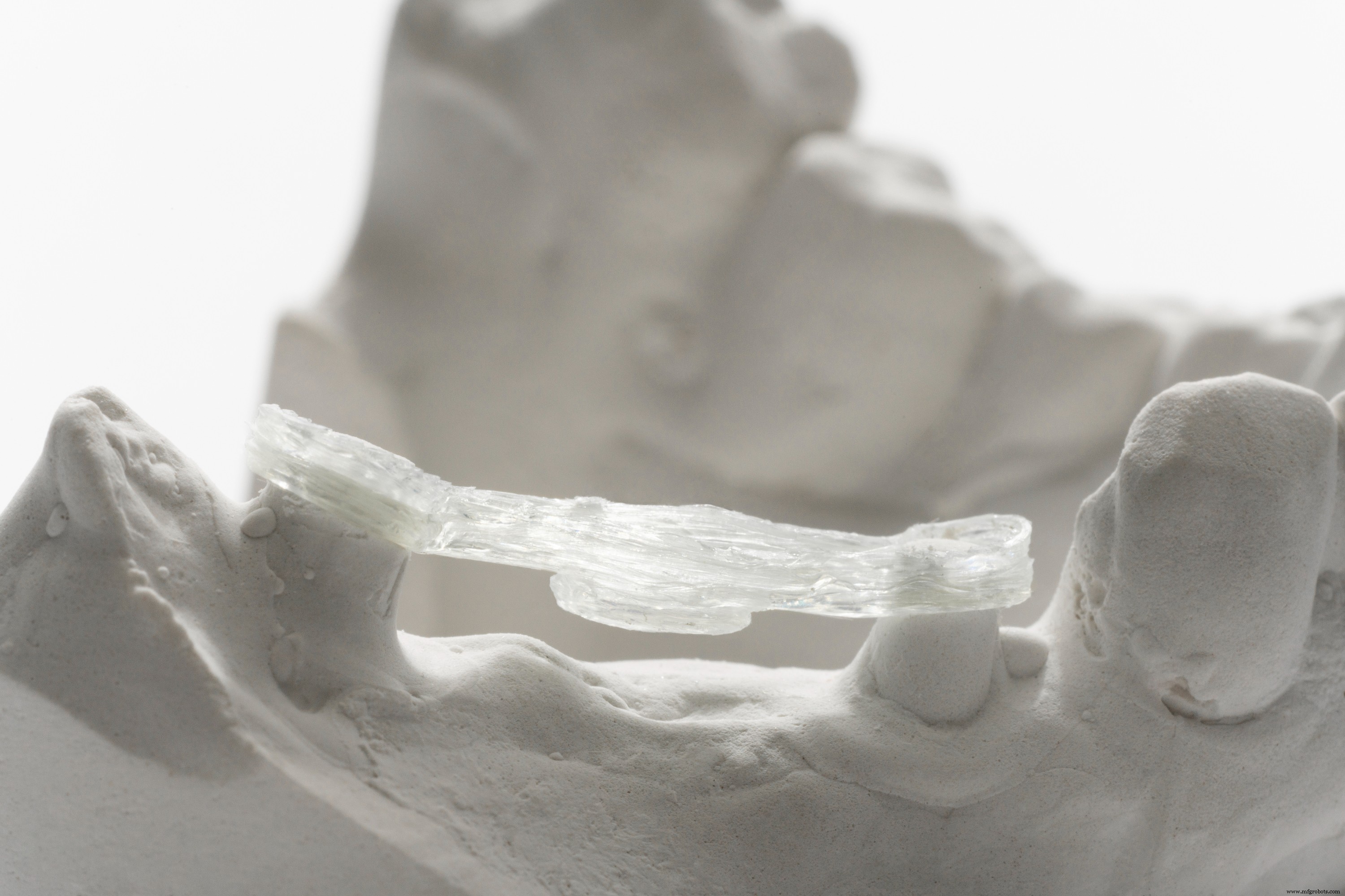Hi-Fiber Launches 3D-Printed Continuous Fiber Dental Reinforcements for Clinical Trials