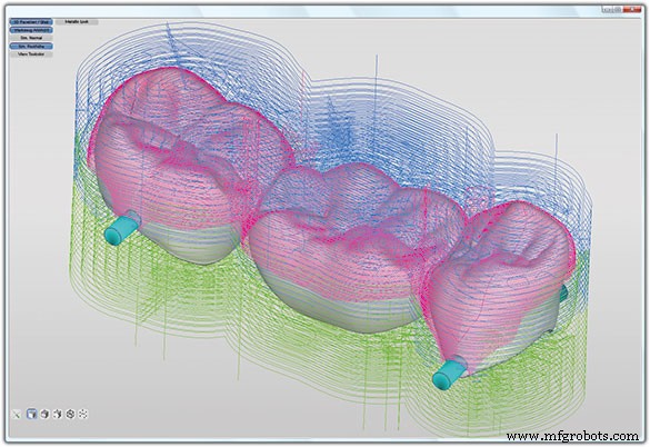 When to In‑Source Metal Milling: 3 Key Indicators for Dental Labs