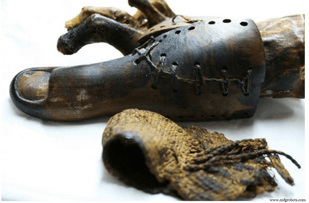 Bionic Sportsmen: Cutting-Edge Prosthetics Empowering Athletic Equality