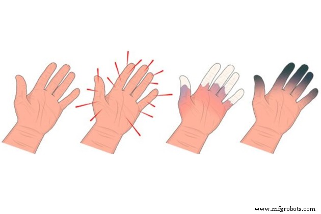 Foundry Safety Precautions in Casting Workshops: Protecting Workers from Hazards