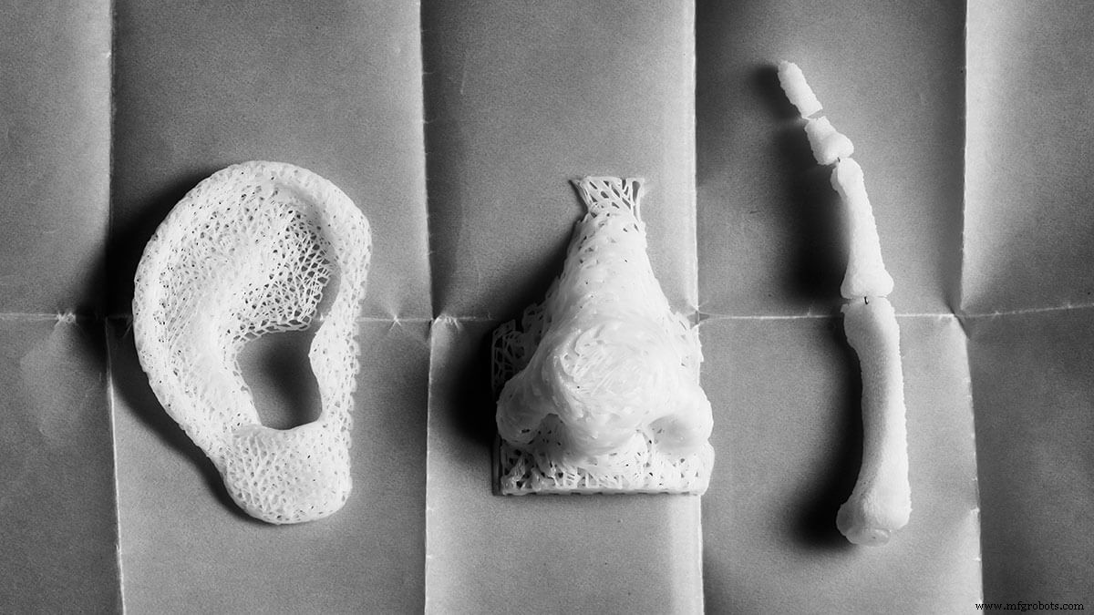 South African Surgeons Achieve Groundbreaking 3D‑Printed Ear Transplant