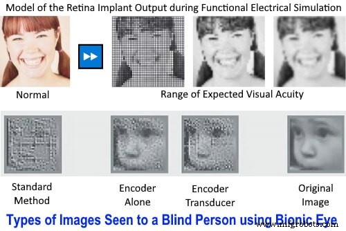 Bionic Eye Technology: How It Works and Its Benefits