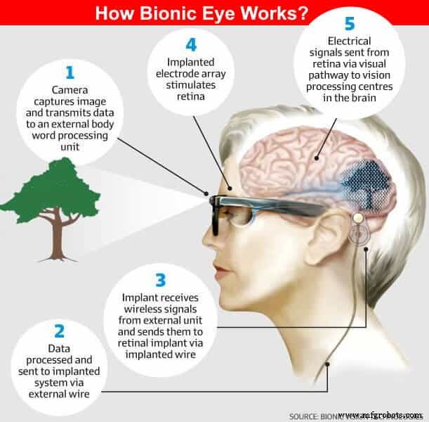 Bionic Eye Technology: How It Works and Its Benefits
