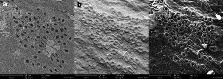 Scanning Electron Microscopy (SEM): Unveiling Materials Defects with Advanced Imaging