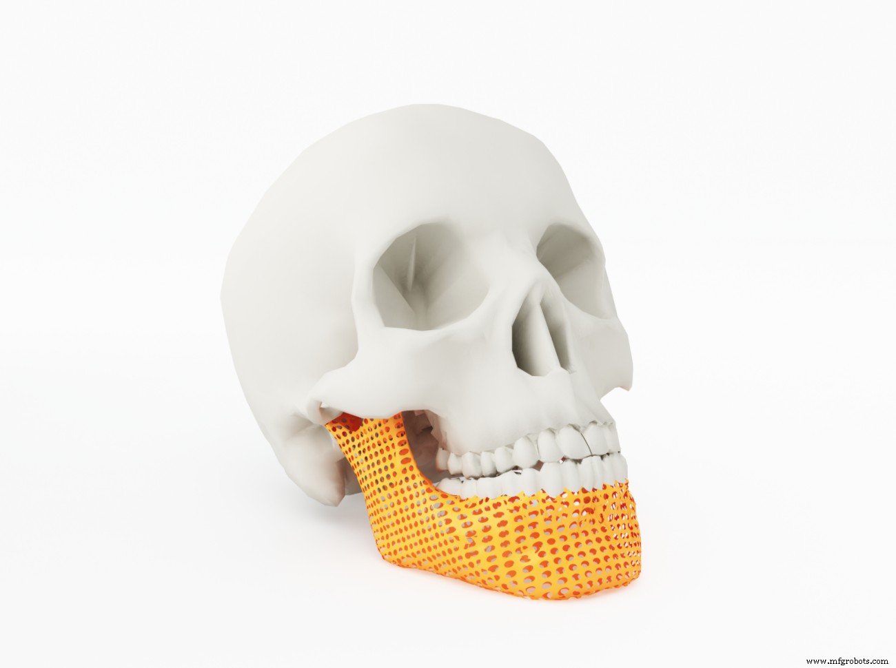 Top 5 Trends Accelerating Growth in Medical Device Manufacturing