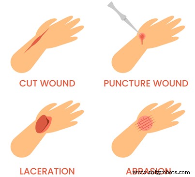 Understanding Lacerations: Causes, Treatments, and Prevention