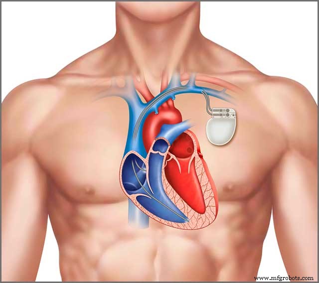 Rigid vs. Flexible PCBs: 10 Essential Comparison Points