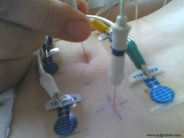 EGM Sensor Explained: How It Works and Practical Uses