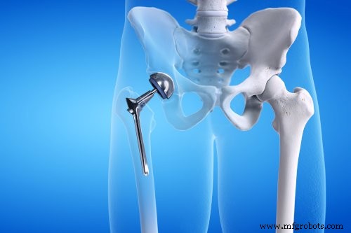 Top CNC Machining Applications Transforming Medical Device Production