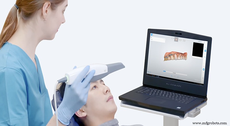 Essential Factors for Accurate 3D Object Scanning