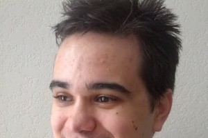 世界のスキンケア業界を理解する:トレンドと主要企業 