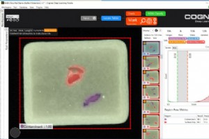 Cognex VisionPro ディープラーニング ツールでファクトリー オートメーションを強化 
