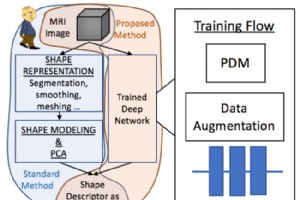 AI 检测房颤复发的准确率达到 90% 