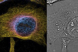 PRISM 技术打破了时空活细胞成像的光衍射极限 